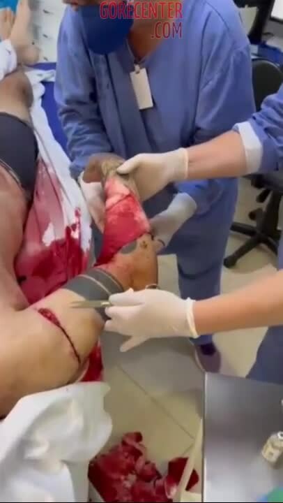 Preview for aftermath of machete fight