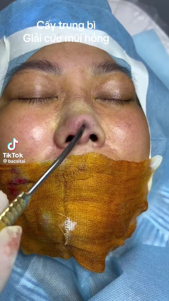 Preview for 16957136